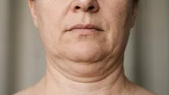 5 cvikov, ktoré pomáhajú zbaviť sa dvojitej brady